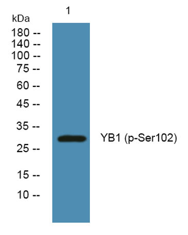 YB1 (phospho-Ser102)  rabbit pAb