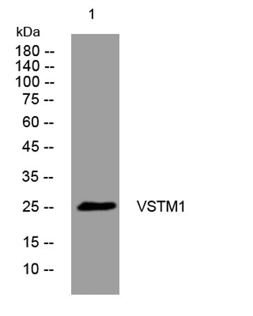 VSTM1 rabbit pAb