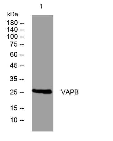 VAPB rabbit pAb