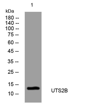 UTS2B rabbit pAb