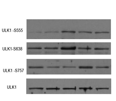 ULK1 (phospho-Ser757)  rabbit pAb