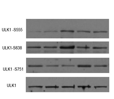 ULK1 (phospho-Ser555)  rabbit pAb
