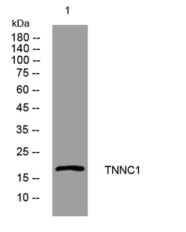 TNNC1 rabbit pAb