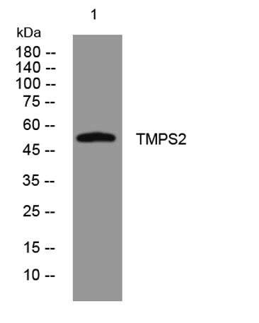 TMPS2 rabbit pAb
