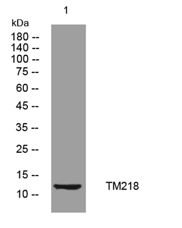 TM218 rabbit pAb