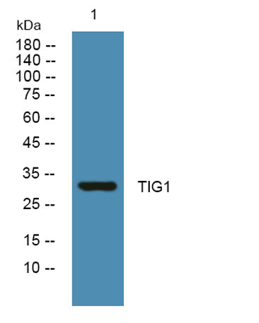 TIG1 rabbit pAb