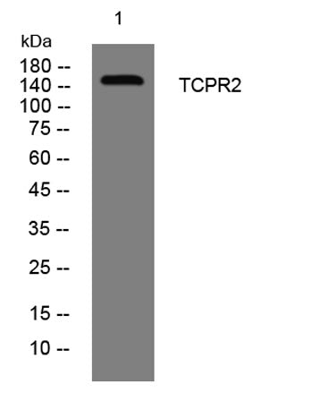 TCPR2 rabbit pAb