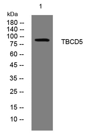 TBCD5 rabbit pAb