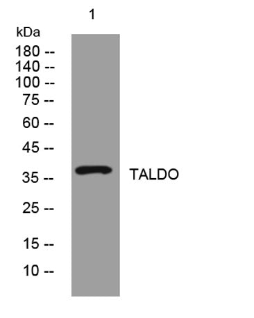 TALDO rabbit pAb