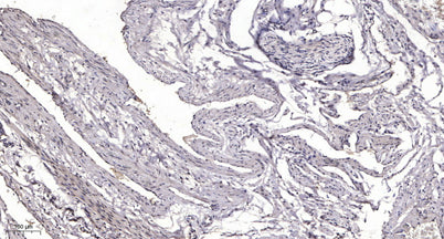 Syk (phospho-Ser297) rabbit pAb