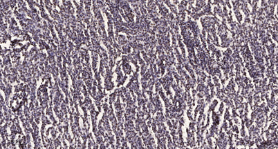 Stat3 (Acetyl-Lys49) rabbit pAb