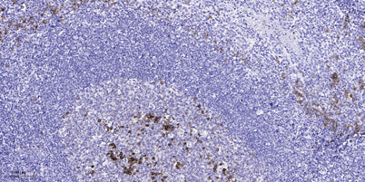 SREBP-1 (Acetyl-Lys324) rabbit pAb