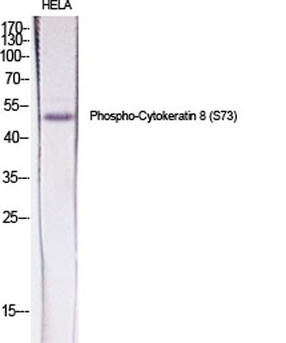 Cytokeratin 8 (phospho Ser73) rabbit pAb