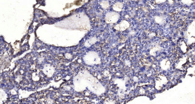 SQSTM1/p62 (phospho-Thr269/Ser272) rabbit pAb