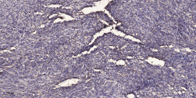 SQSTM1/p62 (phospho-Ser403)  rabbit pAb