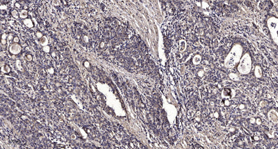 SQSTM1/p62 (phospho-Ser349) rabbit pAb