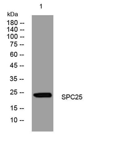 SPC25 rabbit pAb