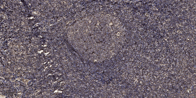 Smad3 (phospho-Ser423/425)  rabbit pAb