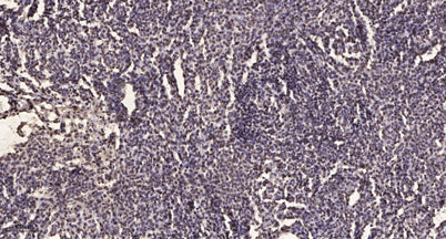 Smad2/3 (Acetyl-Lys19) rabbit pAb