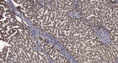 SLP-76 (phospho-Tyr145) rabbit pAb