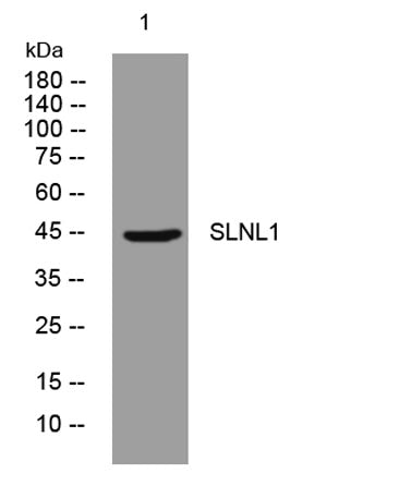 SLNL1 rabbit pAb