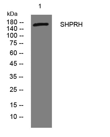 SHPRH rabbit pAb