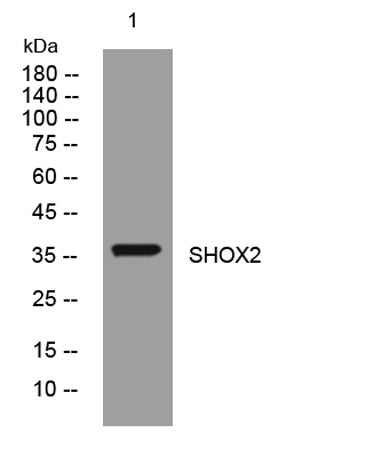 SHOX2 rabbit pAb