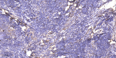SGK3 (phospho-Thr320)  rabbit pAb
