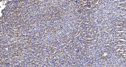 SF3B1 (phospho-Thr313)  rabbit pAb