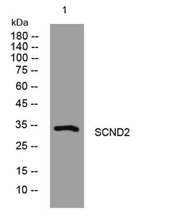 SCND2 rabbit pAb