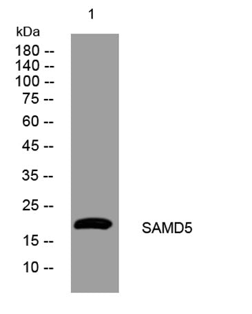 SAMD5 rabbit pAb