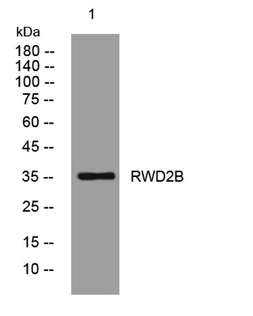 RWD2B rabbit pAb