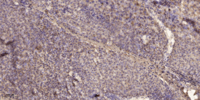 Rictor (phospho-Thr1135)  rabbit pAb