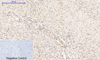 NFκB-p65 (phospho Ser276) rabbit pAb