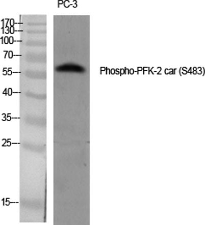 PFK-2 car (phospho Ser483) rabbit pAb