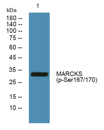 MARCKS (phospho-Ser167/170)  rabbit pAb