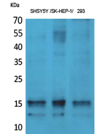 Synuclein-α (phospho Tyr125) rabbit pAb