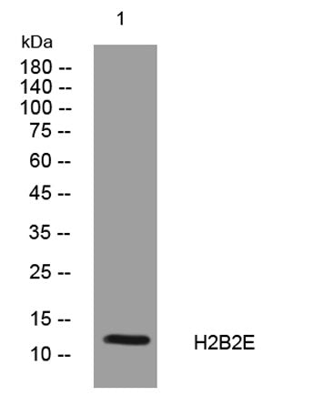 H2B2E rabbit pAb