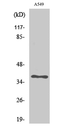 AKR1CL2 rabbit pAb