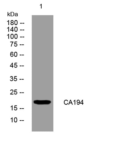 CA194 rabbit pAb