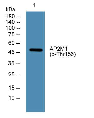AP2M1 (phospho-Thr156)  rabbit pAb