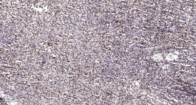 ANR11 rabbit pAb