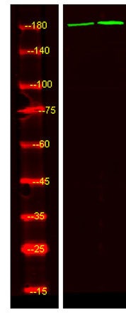ALK (phospho-Tyr1078)  rabbit pAb