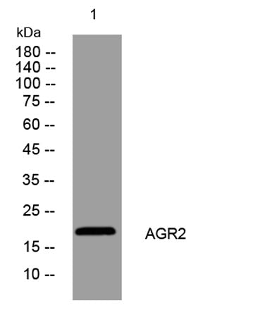 AGR2 rabbit pAb