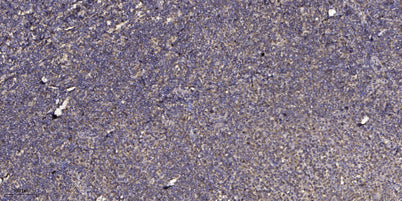 Adrenocorticotropin(ACTH) rabbit pAb