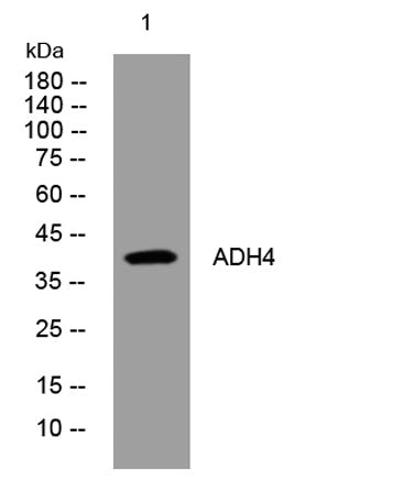 ADH4 rabbit pAb