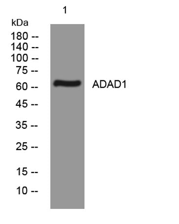 ADAD1 rabbit pAb