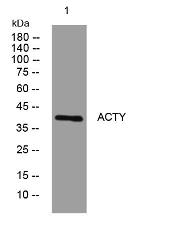 ACTY rabbit pAb