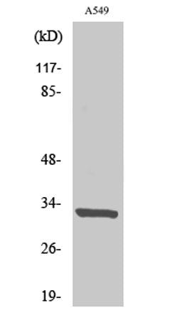 CD20 rabbit pAb