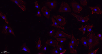 ChemR23 rabbit pAb